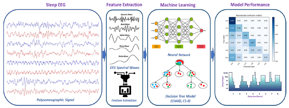 Quantitative Evaluation of EEG-Biomarkers for Prediction of Sleep Stages